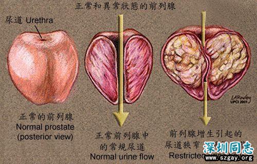 h77M100EMRA8r8mD.jpg